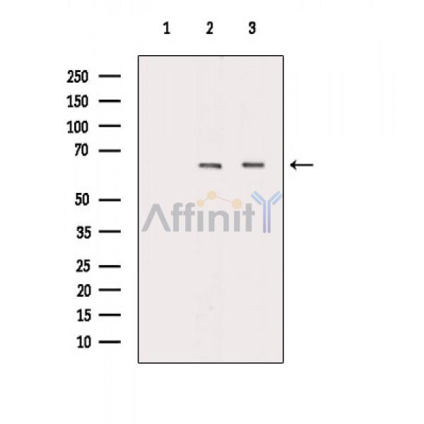 ARSI Antibody - Western blot analysis of extracts from various samples, using ARSI Antibody.