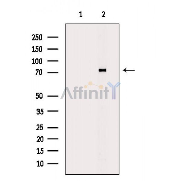 CLIP4 Antibody - Western blot analysis of extracts from Rat brain, using CLIP4 Antibody.