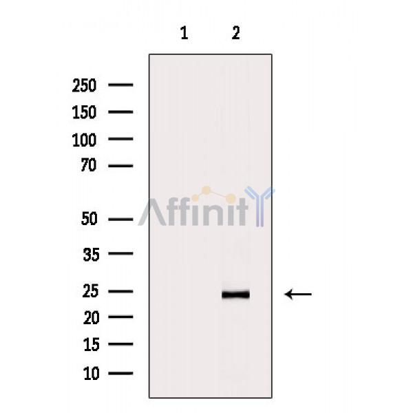 IL6 Antibody - Western blot analysis of extracts from Rat heart, using IL6 Antibody.