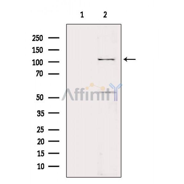 TLR8 Antibody - Western blot analysis of extracts from HepG2 cells(LPS 4h treatment), using TLR8 Antibody.