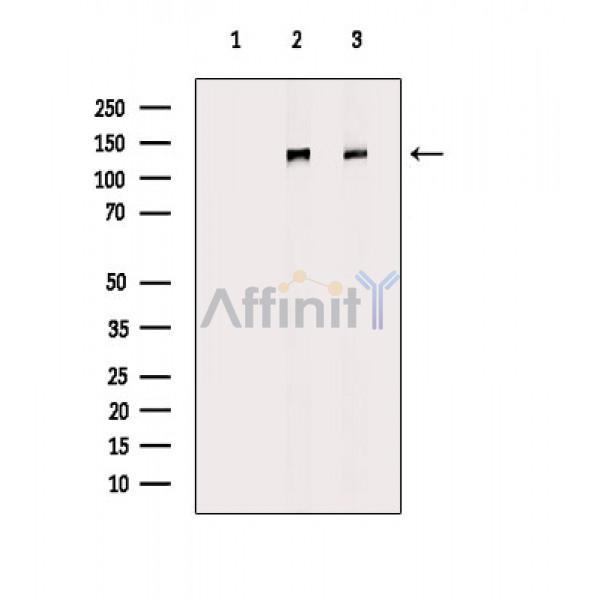 DCTN1 Antibody - Western blot analysis of extracts from various samples, using DCTN1 Antibody.