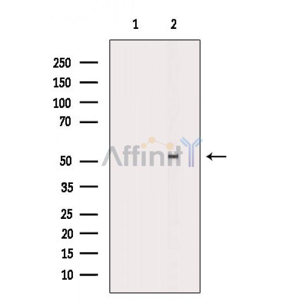 GABRA2 Antibody - Western blot analysis of extracts from Mouse kidney, using GABRA2 Antibody.