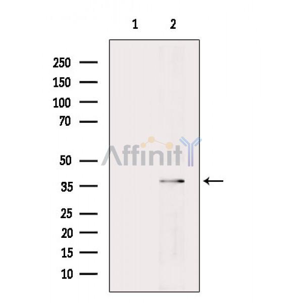 UCHL5 Antibody - Western blot analysis of extracts from Rat heart, using UCHL5 Antibody.
