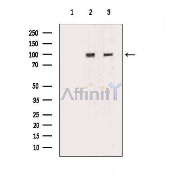 CHD1L Antibody - Western blot analysis of extracts from various samples, using CHD1L Antibody.