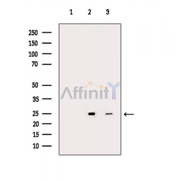 IL32 Antibody - Western blot analysis of extracts from various samples, using IL32 Antibody.