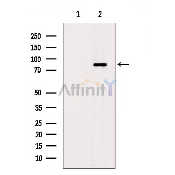 Sec23B Antibody - Western blot analysis of extracts from HepG2 cells(LPS 4h treatment), using Sec23B Antibody.