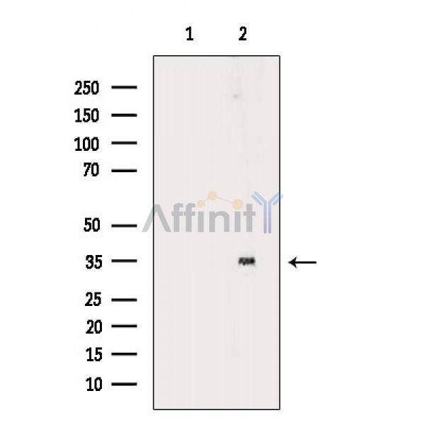DOK5 Antibody - Western blot analysis of extracts from Mouse brain, using DOK5 Antibody.