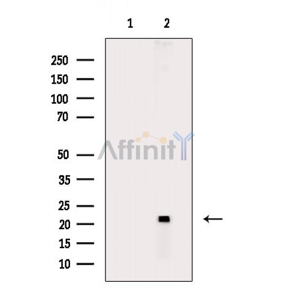 TPD52L1 Antibody - Western blot analysis of extracts from HepG2 cells(heat-shock treatment), using TPD52L1 Antibody.