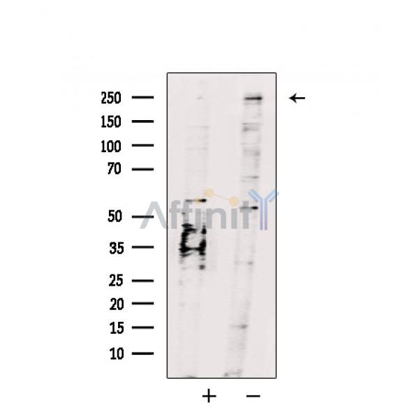 MYST4 Antibody - Western blot analysis of extracts from Hela cells, using MYST4 Antibody.