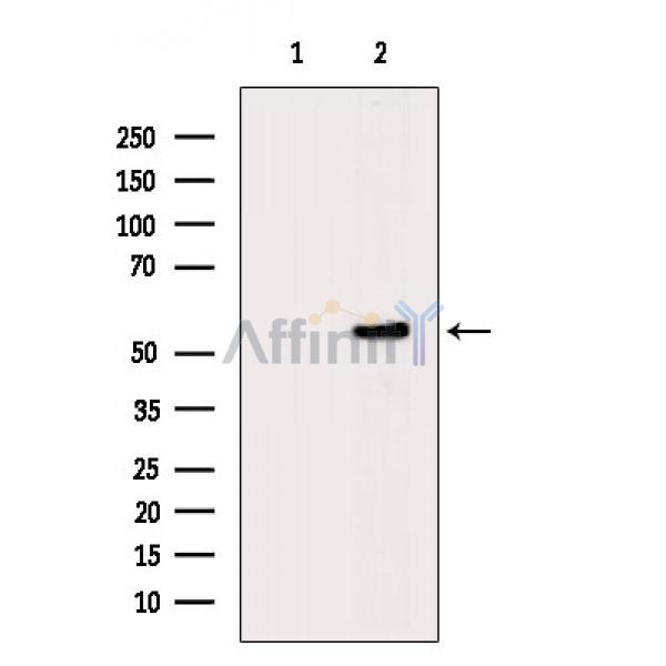Phospho-AKT1/2/3 (Ser473) Antibody - Western blot analysis of extracts from VERO cells(H2O2 treatment), using Phospho-pan-AKT1/2/3 (Ser473) Antibody.