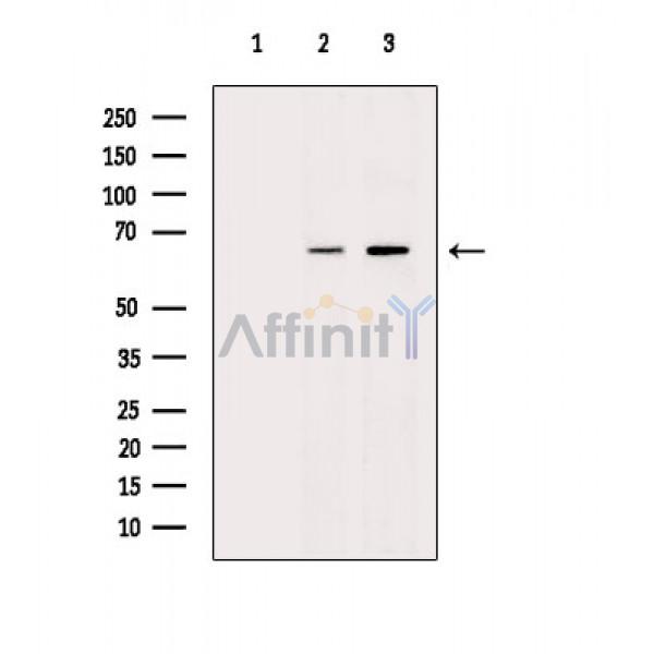 NF-kB p65 Antibody - Western blot analysis of extracts from various samples, using NF-kB p65 Antibody.