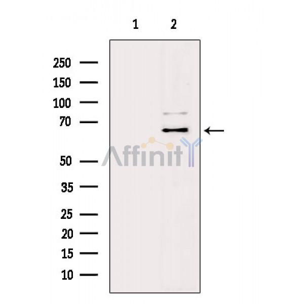 NF-kB p65 Antibody - Western blot analysis of extracts from HepG2 cells(serum starvation treatment), using NF-kB p65 Antibody.
