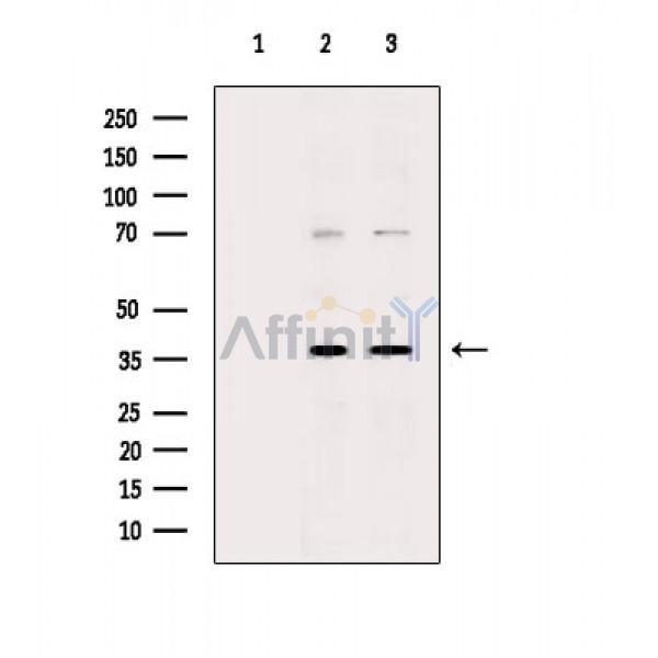 Nucleophosmin Antibody - Western blot analysis of extracts from various samples, using Nucleophosmin Antibody.