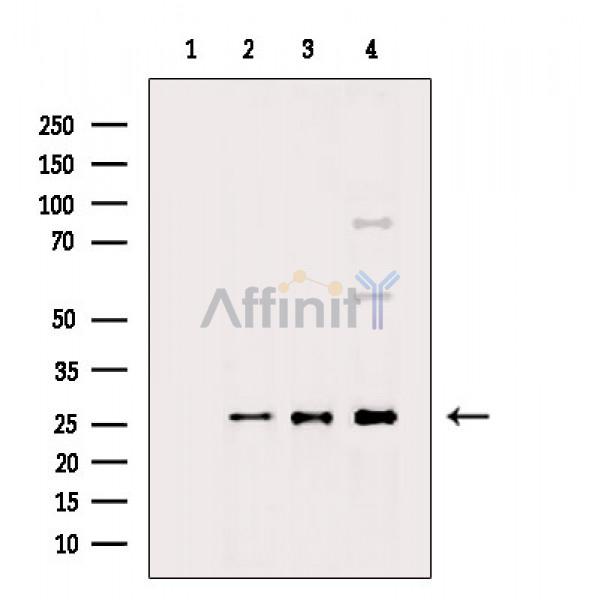 TIMP4 Antibody - Western blot analysis of extracts from various samples, using TIMP4 Antibody.