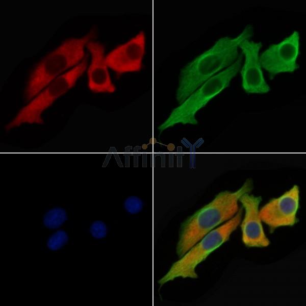 TNF alpha Antibody - AF7014 staining Hela cells by IF/ICC.