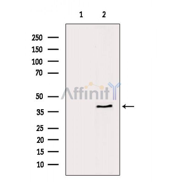 CCR3 Antibody - Western blot analysis of extracts from Hela cells, using CCR3 Antibody.