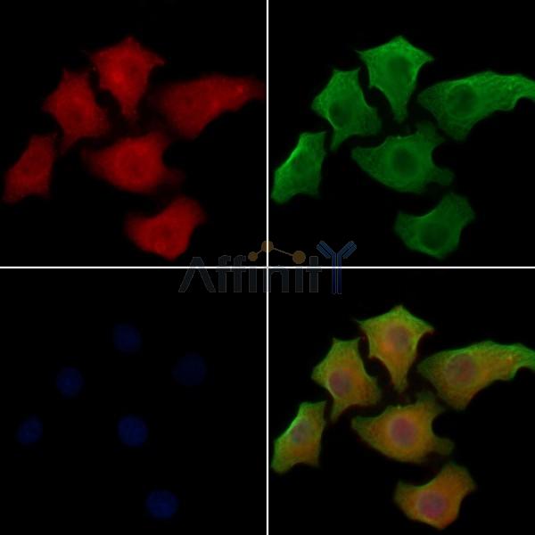 S100A13 Antibody - DF8140 staining Hela cells by IF/ICC.