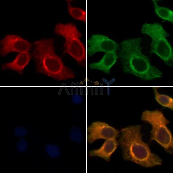 UBE2L6 Antibody - DF8152 staining Hela cells by IF/ICC.