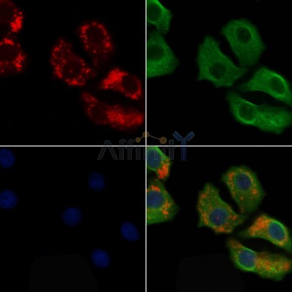 IgG1 Antibody - DF8170 staining Hela cells by IF/ICC.