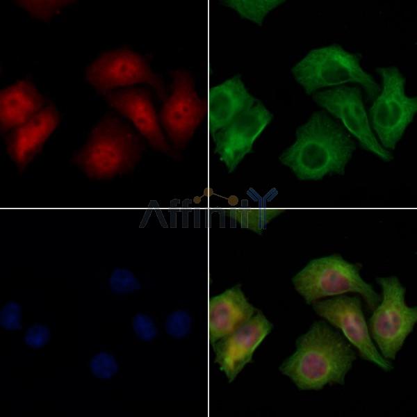 XPO4 Antibody - DF8190 staining Hela cells by IF/ICC.
