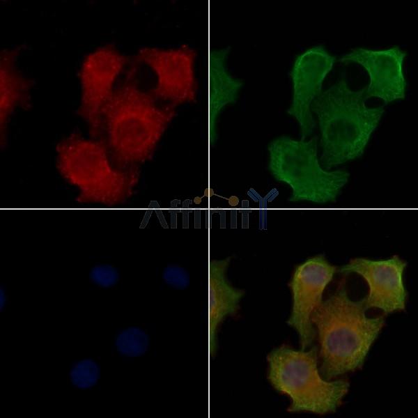 ORM2 Antibody - DF8280 staining Hela cells by IF/ICC.