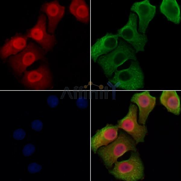 CHD5 Antibody - DF8374 staining Hela cells by IF/ICC.
