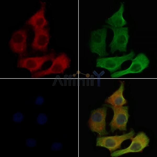 CD179b Antibody - DF8516 staining Hela cells by IF/ICC.