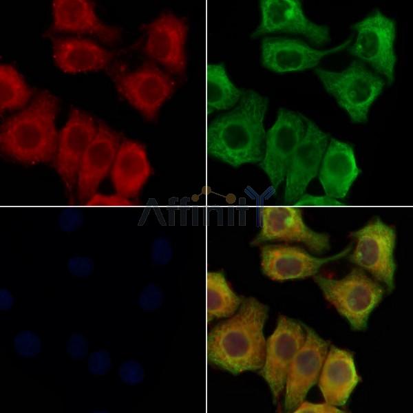 CNP-53 Antibody - DF8522 staining Hela cells by IF/ICC.