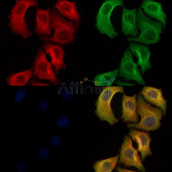 GCS beta 2 Antibody - DF8552 staining Hela cells by IF/ICC.