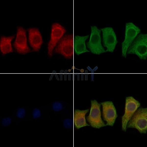 Sec23B Antibody - DF8607 staining Hela cells by IF/ICC.