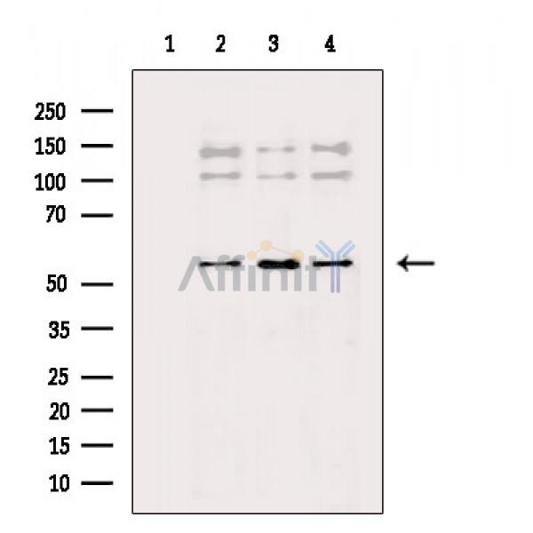 pan-AKT1/2/3 Antibody - Western blot analysis of extracts from various samples, using pan-AKT1/2/3 Antibody.