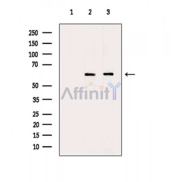 SQSTM1/p62 Antibody - Western blot analysis of extracts from various samples, using SQSTM1/p62 Antibody.