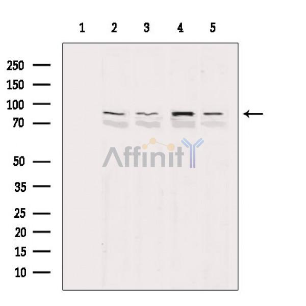 Cleaved-PARP (Asp214) Antibody - Western blot analysis of extracts from various samples, using Cleaved-PARP (Asp214) Antibody.