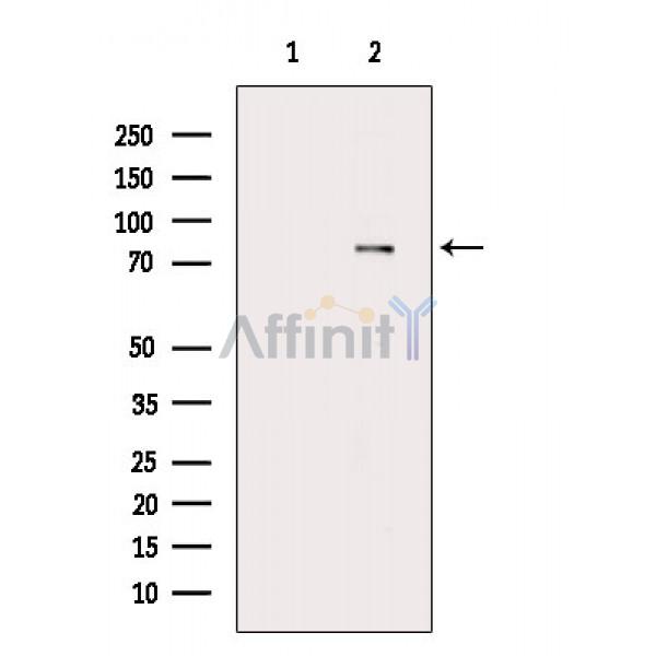Phospho-DRP1 (Ser616) Antibody - Western blot analysis of extracts from Mouse brain, using Phospho-DRP1 (Ser616) Antibody.
