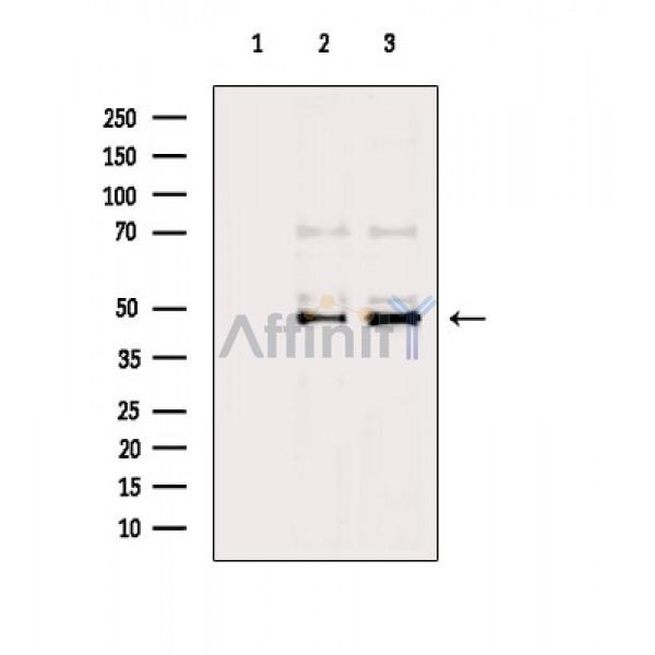 RSAD2 Antibody - Western blot analysis of extracts from various samples, using RSAD2 Antibody.