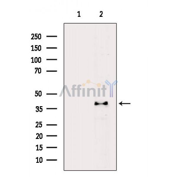 ZNF75 Antibody - Western blot analysis of extracts from Rat heart, using ZNF75 Antibody.