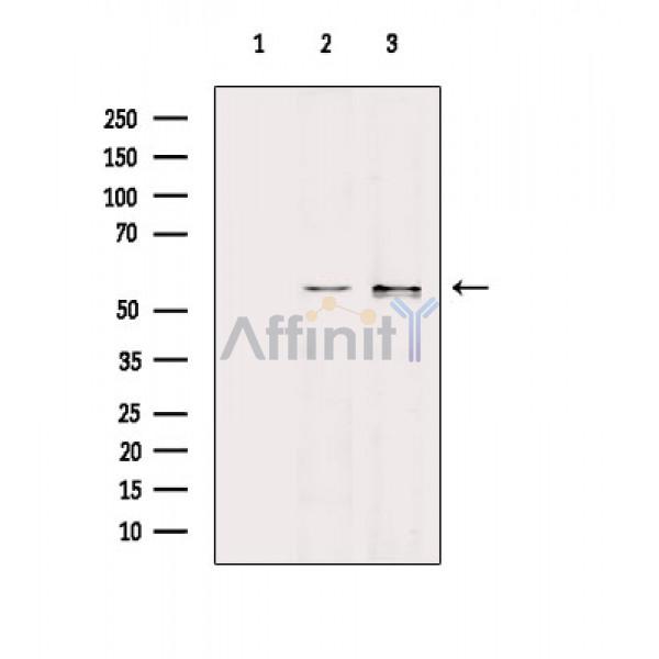 IgA Antibody - Western blot analysis of extracts from various samples, using IgA Antibody.