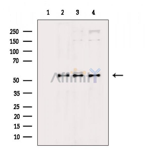 Phospho-AKT1/2/3 (Ser473) Antibody - Western blot analysis of extracts from various samples, using Phospho-pan-AKT1/2/3 (Ser473) Antibody.
