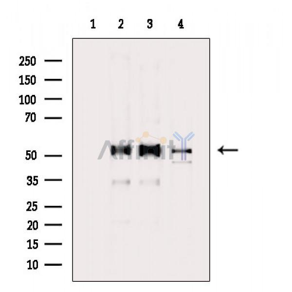 alpha Tubulin Antibody - Western blot analysis of extracts from various samples, using alpha Tubulin Antibody.