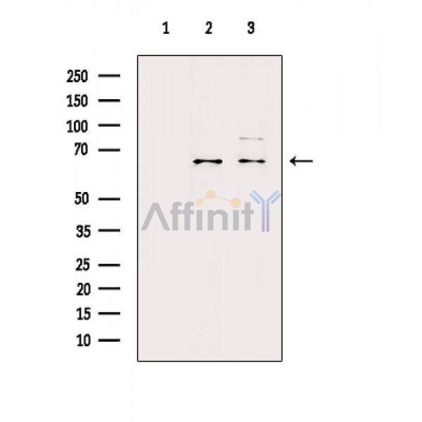 NF-kB p65 Antibody - Western blot analysis of extracts from various samples, using NF-kB p65 Antibody.