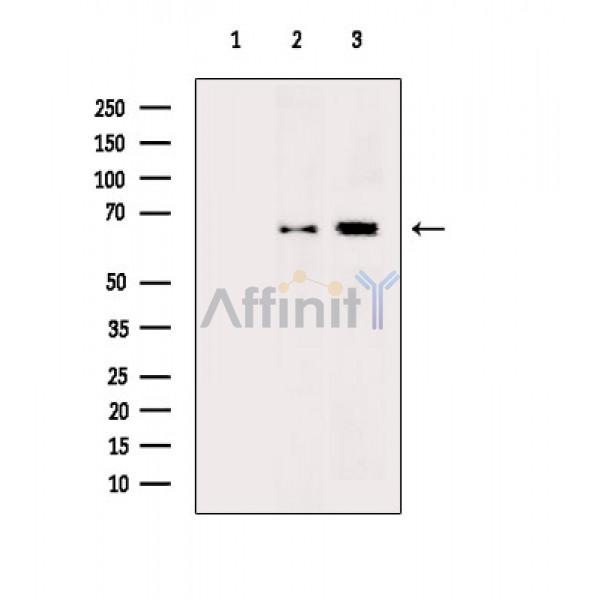 NF-kB p65 Antibody - Western blot analysis of extracts from various samples, using NF-kB p65 Antibody.