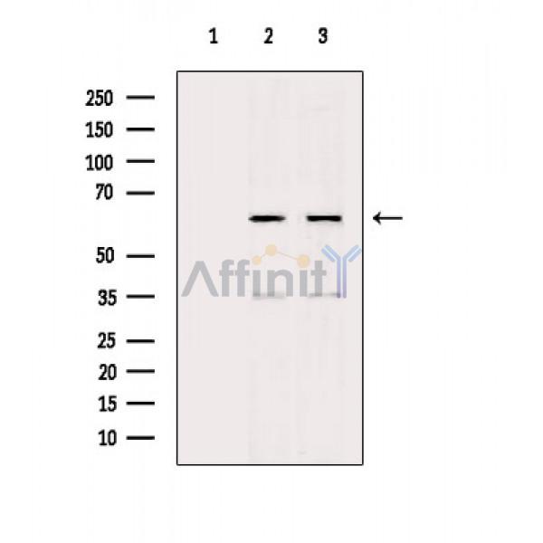 AMPK alpha Antibody - Western blot analysis of extracts from various samples, using AMPK alpha Antibody.