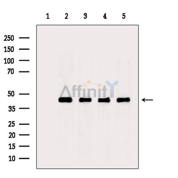 beta Actin Antibody - Western blot analysis of extracts from various samples, using beta Actin Antibody.