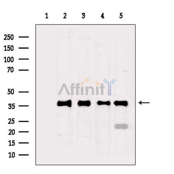GAPDH Antibody - Western blot analysis of extracts from various samples, using GAPDH Antibody.