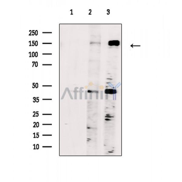 SYCP2 Antibody - Western blot analysis of extracts from various samples, using SYCP2 Antibody.