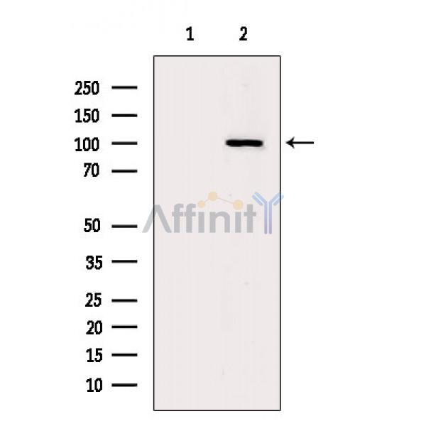 APP Antibody - Western blot analysis of extracts from A549 cells(heat-shock treatment), using APP Antibody.