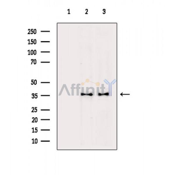 PCNA Antibody - Western blot analysis of extracts from various samples, using PCNA Antibody.
