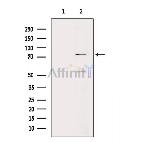 PKC alpha Antibody - Western blot analysis of extracts from A549 cells(serum starvation treatment), using PKC alpha Antibody.