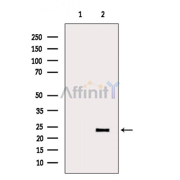 IL6 Antibody - Western blot analysis of extracts from Rat muscle, using IL6 Antibody.