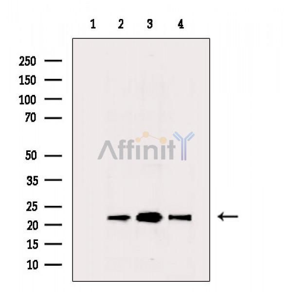 Peroxiredoxin 2 Antibody - Western blot analysis of extracts from various samples, using Peroxiredoxin 2 Antibody.